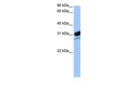 MRPL24 Antibody in Western Blot (WB)