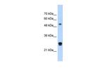 IGSF1 Antibody in Western Blot (WB)