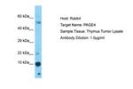 PAGE4 Antibody in Western Blot (WB)
