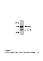 FBXO7 Antibody in Western Blot (WB)