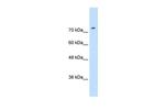 SLC7A1 Antibody in Western Blot (WB)