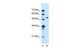 SLC37A3 Antibody in Western Blot (WB)