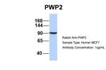 PWP2 Antibody in Western Blot (WB)