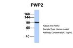 PWP2 Antibody in Western Blot (WB)