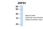 ZNF93 Antibody in Western Blot (WB)