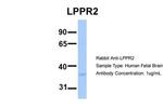 LPPR2 Antibody in Western Blot (WB)
