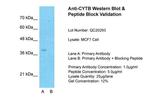 MT-CYB Antibody in Western Blot (WB)