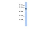CXorf67 Antibody in Western Blot (WB)