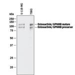 GPNMB Antibody in Western Blot (WB)
