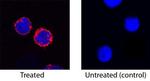 TREM1 Antibody in Immunocytochemistry (ICC/IF)