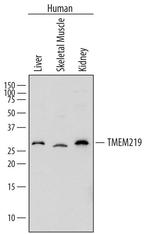 TMEM219 Antibody in Western Blot (WB)