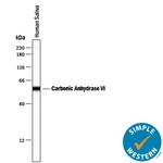 Carbonic Anhydrase VI Antibody in Western Blot (WB)