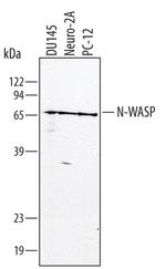N-WASP Antibody in Western Blot (WB)