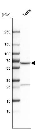 TKTL1 Antibody in Western Blot (WB)