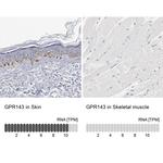 GPR143 Antibody in Immunohistochemistry (IHC)