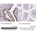 Adenylate Kinase 1 Antibody in Immunohistochemistry (IHC)