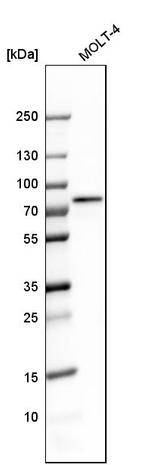 RBM14 Antibody in Western Blot (WB)