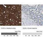 SV2A Antibody in Immunohistochemistry (IHC)
