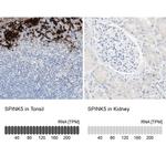 SPINK5 Antibody in Immunohistochemistry (IHC)