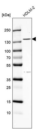 C6orf170 Antibody in Western Blot (WB)