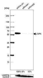 LNP Antibody