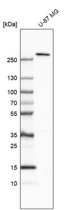 TMPRSS15 Antibody in Western Blot (WB)