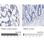 TREML1 Antibody in Immunohistochemistry (IHC)