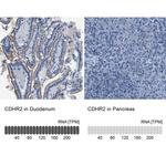 CDHR2 Antibody in Immunohistochemistry (IHC)