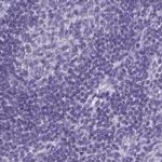 PAPPA2 Antibody in Immunohistochemistry (IHC)