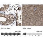 GCN1L1 Antibody in Immunohistochemistry (IHC)