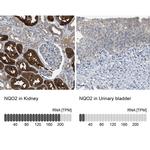 NQO2 Antibody in Immunohistochemistry (IHC)