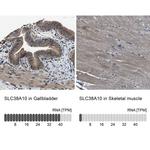 SLC38A10 Antibody in Immunohistochemistry (IHC)