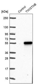 TWISTNB Antibody in Western Blot (WB)