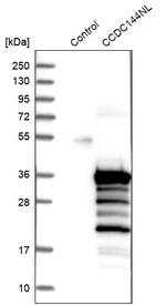 MGC87631 Antibody in Western Blot (WB)