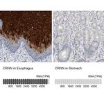 CRNN Antibody in Immunohistochemistry (IHC)