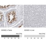 ADAM2 Antibody in Immunohistochemistry (IHC)