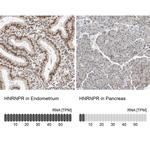 hnRNP R Antibody in Immunohistochemistry (IHC)