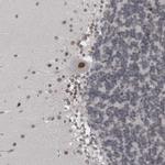 PSMB2 Antibody in Immunohistochemistry (IHC)
