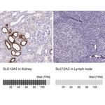 SLC12A3 Antibody in Immunohistochemistry (IHC)