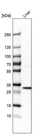 BDH1 Antibody in Western Blot (WB)