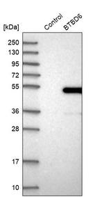 BTBD6 Antibody in Western Blot (WB)