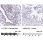 ANKRD45 Antibody in Immunohistochemistry (IHC)