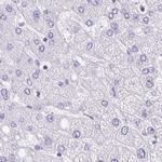 ANKRD45 Antibody in Immunohistochemistry (IHC)
