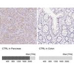 CTRL Antibody in Immunohistochemistry (IHC)
