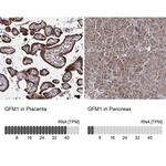 GFM1 Antibody in Immunohistochemistry (IHC)