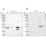 Grancalcin Antibody in Western Blot (WB)