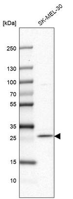 FAM168A Antibody in Western Blot (WB)