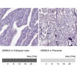 ARMC4 Antibody in Immunohistochemistry (IHC)