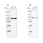 RPAP3 Antibody in Western Blot (WB)