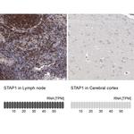 STAP1 Antibody in Immunohistochemistry (IHC)